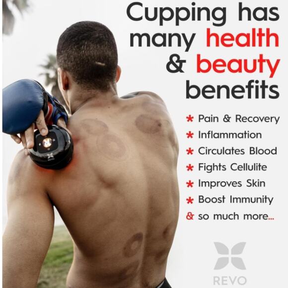 REVO The Original 4-in-1 Smart Cupping Therapy Massager Bundle NEW - Picture 5 of 11